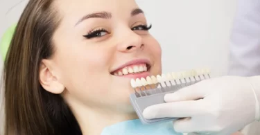 What are Porcelain Veneers