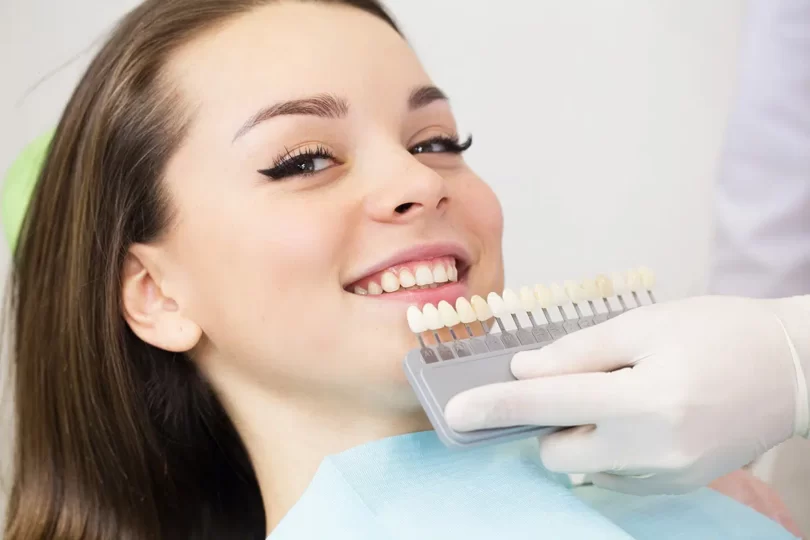 What are Porcelain Veneers